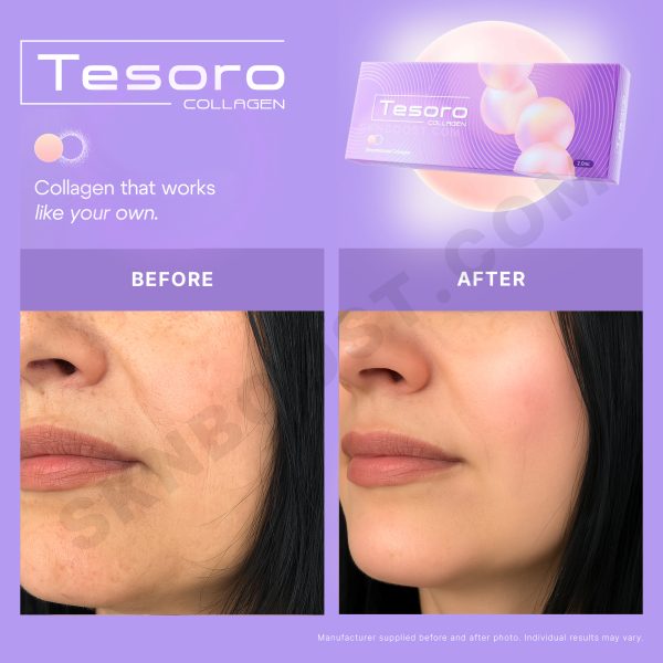 TESORO Collagen Skin Booster - Image 3